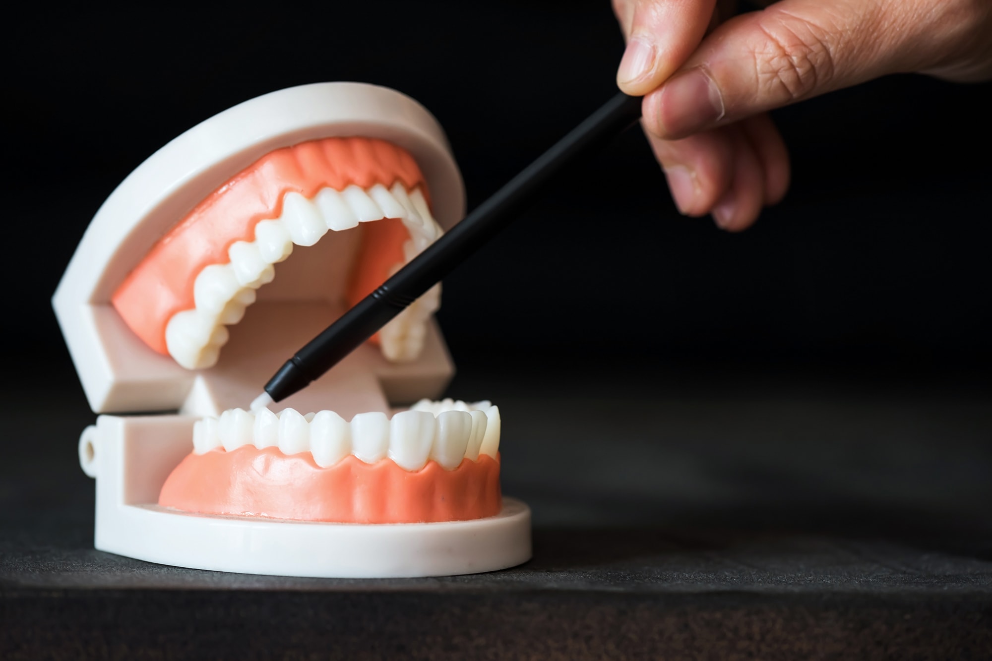 tipos de dientes