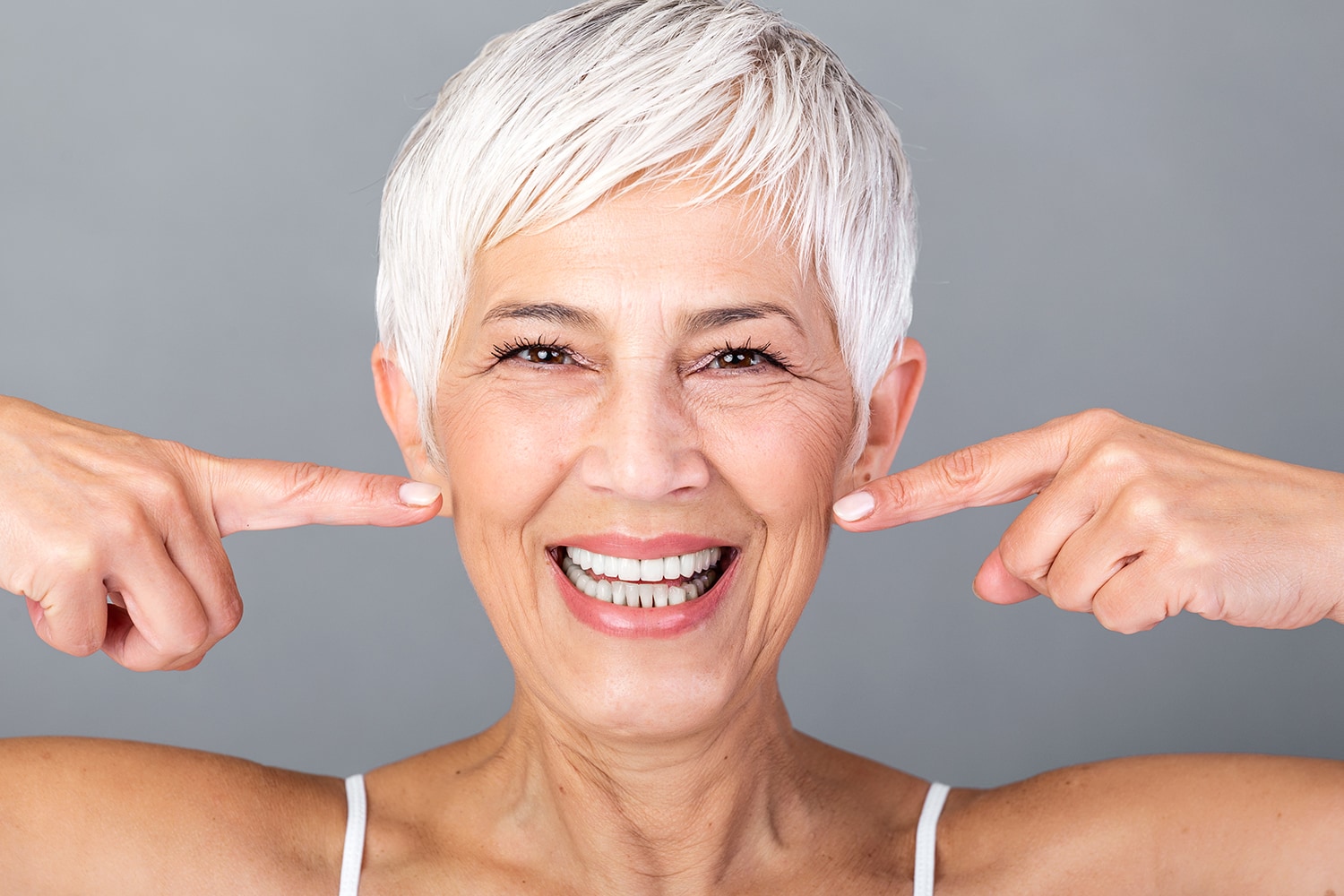 blanqueamiento dental