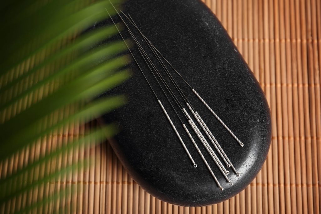 dolor articular acupuntura