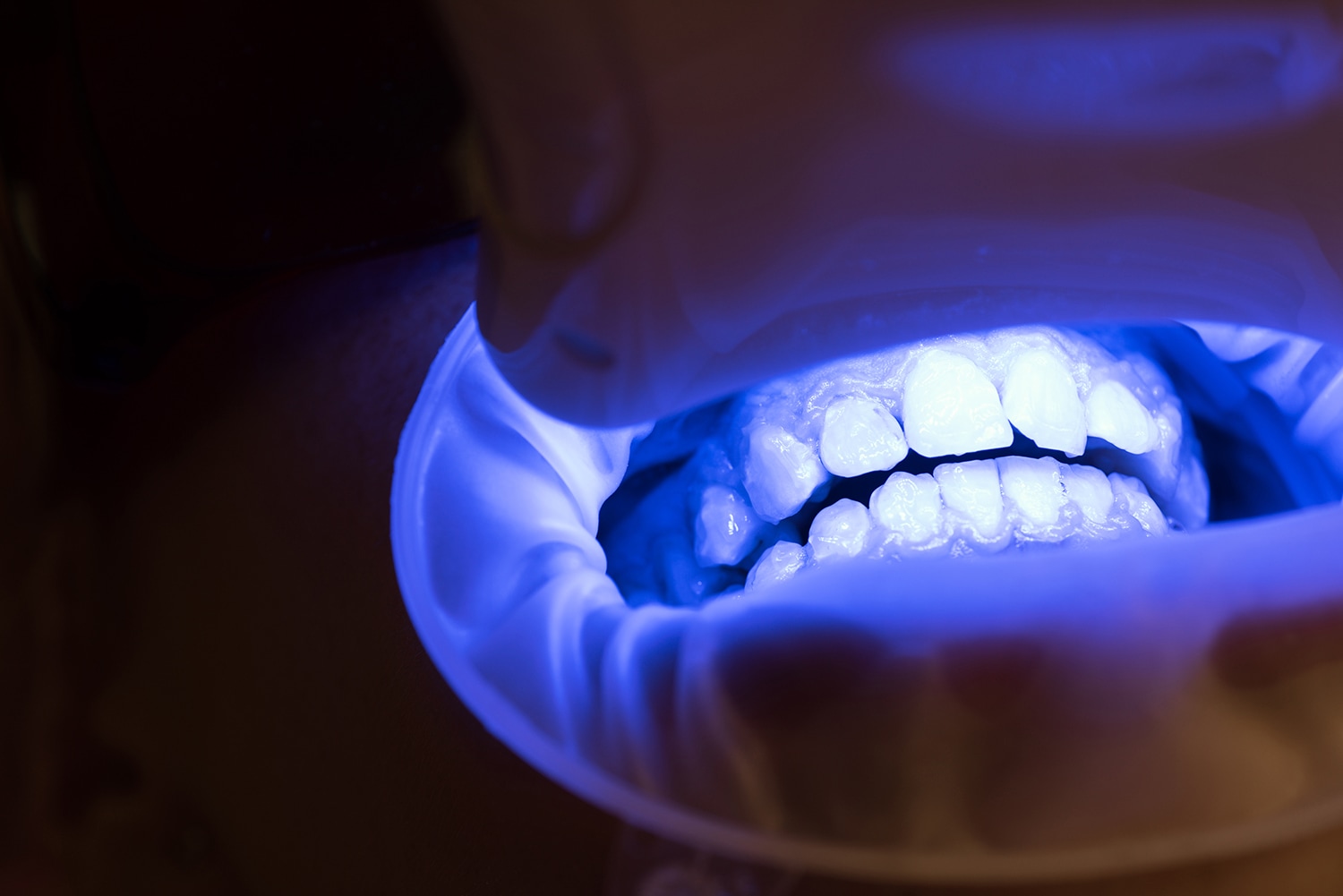 planificacion periodontal