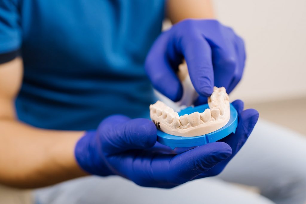 cuidados de los implantes dentales