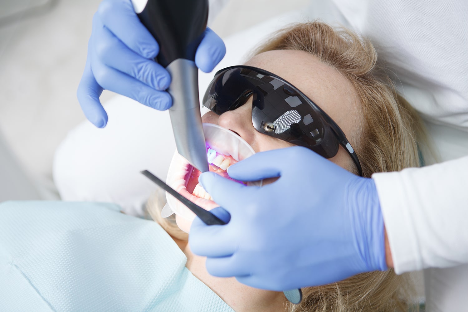 escaner intraoral